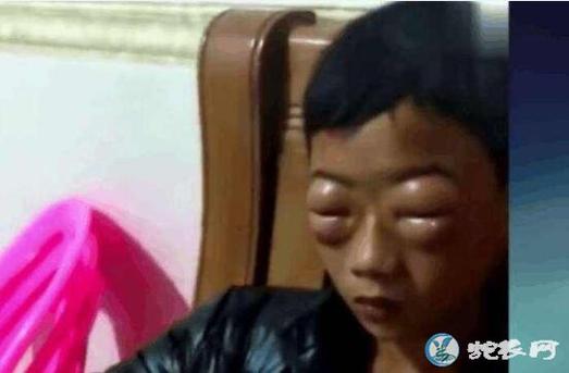 2025新奥历史开奖结果和男子在湖边被蛇咬伤与男子在湖边被蛇咬伤视频